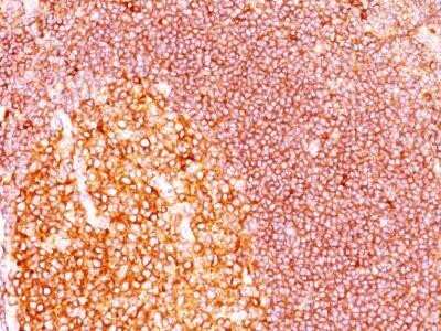 Immunohistochemistry-Paraffin: MALT1 Antibody (MT1/410) - IHC-Prediluted [NBP2-44348]