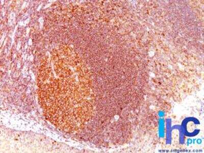 Immunohistochemistry-Paraffin: MALT1 Antibody (MT1/410) [NBP2-29430]