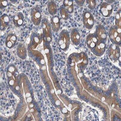 Immunohistochemistry-Paraffin: MAMDC2 Antibody [NBP1-81170]