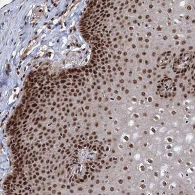 Immunohistochemistry-Paraffin: MAML1 Antibody [NBP1-83025]