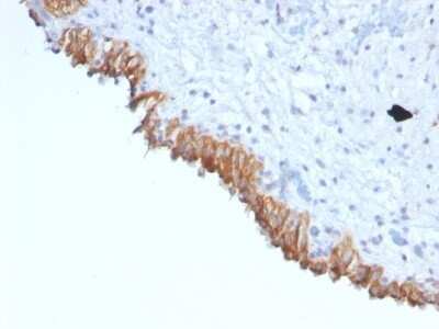 Immunohistochemistry-Paraffin: MAML2 Antibody (MAML2/1302) [NBP2-53228]
