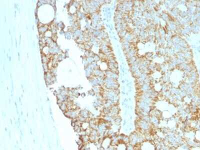 Immunohistochemistry-Paraffin: MAML2 Antibody (MAML2/1302) [NBP2-53228]