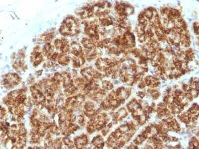 Immunohistochemistry-Paraffin: MAML2 Antibody (MAML2/1302) [NBP2-53228]