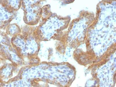 Immunohistochemistry-Paraffin: MAML2 Antibody (MAML2/1302) [NBP2-53228]