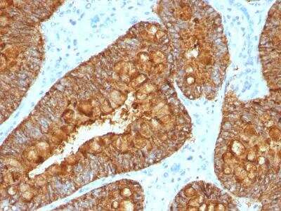 Immunohistochemistry-Paraffin: MAML3 Antibody (MAML3/1303) [NBP2-47646]