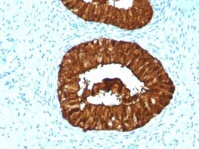 Immunohistochemistry-Paraffin: MAML3 Antibody (MAML3/1303) - Azide and BSA Free [NBP2-54309]