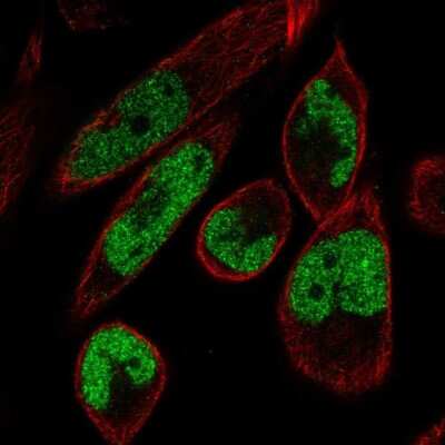 Immunocytochemistry/ Immunofluorescence: MAMLD1 Antibody [NBP1-84530]