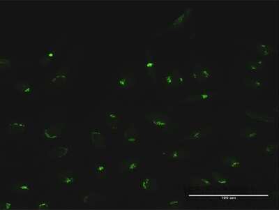 Immunocytochemistry/ Immunofluorescence: MAN1A2 Antibody [H00010905-D01P]