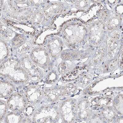 Immunohistochemistry-Paraffin: MAN1A2 Antibody [NBP1-82802]