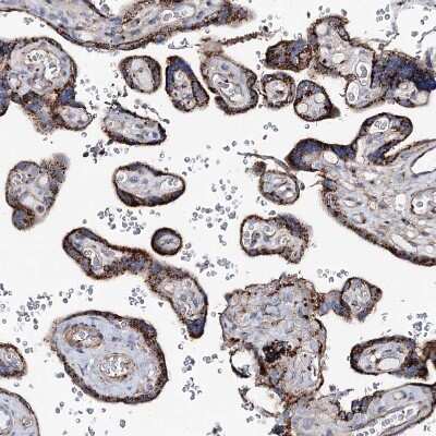 Immunohistochemistry-Paraffin: MAN1A2 Antibody [NBP1-82802]