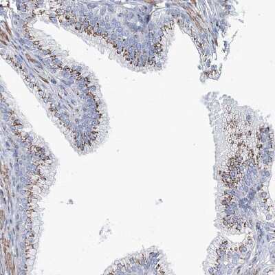 Immunohistochemistry-Paraffin: MAN1A2 Antibody [NBP1-82802]