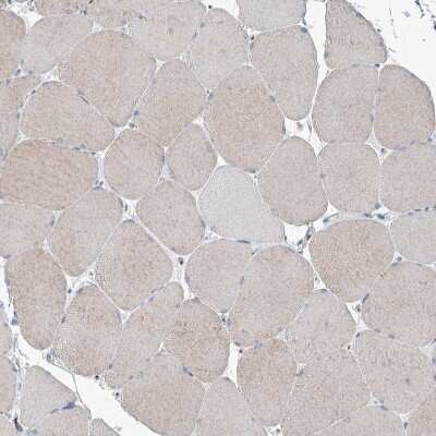 Immunohistochemistry-Paraffin: MAN1A2 Antibody [NBP1-82802]