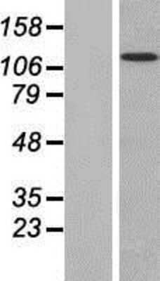 Western Blot: MAN2B2 Overexpression Lysate [NBP2-07195]