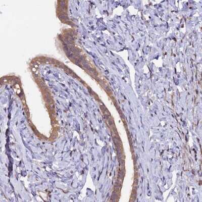 Immunohistochemistry-Paraffin: MAN2C1 Antibody [NBP1-87729]