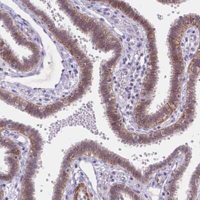 Immunohistochemistry-Paraffin: MAN2C1 Antibody [NBP2-57246]