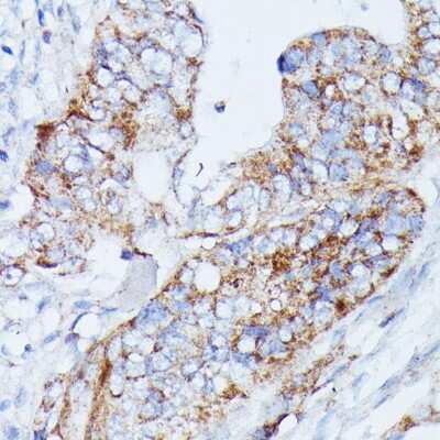 Immunohistochemistry-Paraffin: MANBA Antibody - Azide and BSA Free [NBP3-04803]