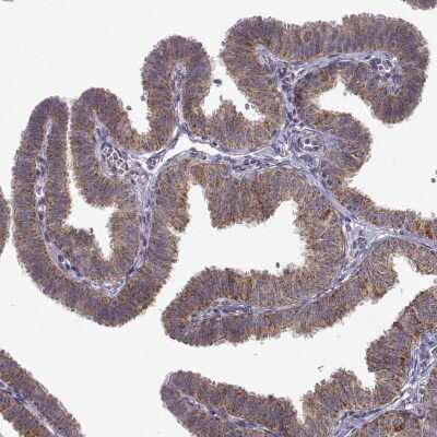 Immunohistochemistry-Paraffin: MANBAL Antibody [NBP2-56848]