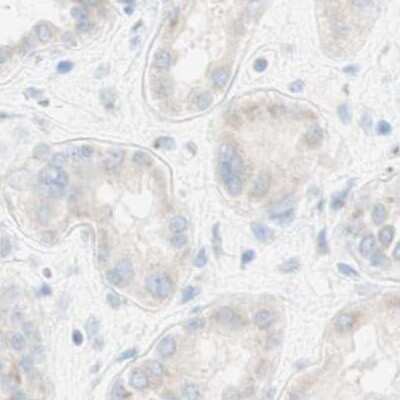 Immunohistochemistry-Paraffin: MANEA Antibody [NBP1-82279]