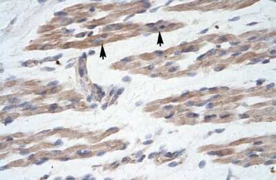 Immunohistochemistry: MANSC1 Antibody [NBP2-85251]