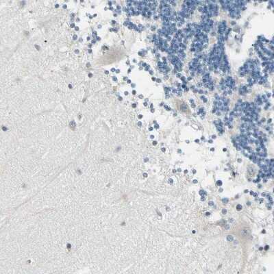 Immunohistochemistry-Paraffin: MANSC1 Antibody [NBP1-83872]