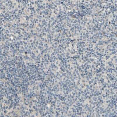 Immunohistochemistry-Paraffin: MANSC1 Antibody [NBP1-83872]