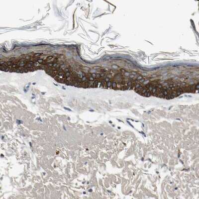 Immunohistochemistry-Paraffin: MANSC1 Antibody [NBP1-83872]