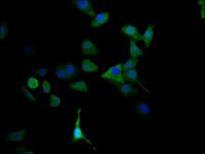 Immunocytochemistry/ Immunofluorescence: MAO-A Antibody (4C11) [NBP3-15161]