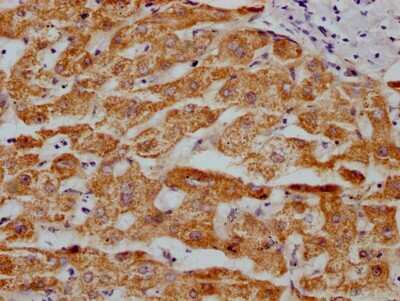 Immunohistochemistry: MAO-A Antibody (4C11) [NBP3-15161]