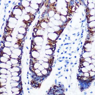 Immunohistochemistry-Paraffin: MAO-A Antibody (9U8P8) [NBP3-16332]