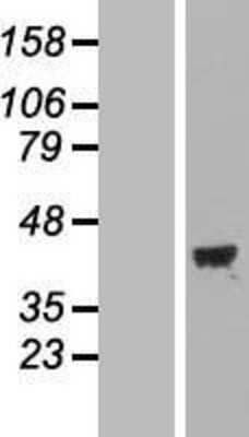 Western Blot: MAP1 Overexpression Lysate [NBL1-13168]