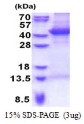SDS-PAGE: Recombinant Human MAP1 His Protein [NBP2-23249]