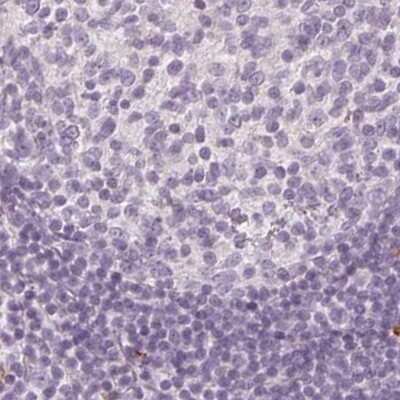 Immunohistochemistry-Paraffin: MAP1A Antibody [NBP2-32630]