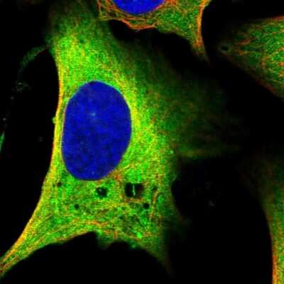 Immunocytochemistry/ Immunofluorescence: MAP1B Antibody [NBP1-81261]