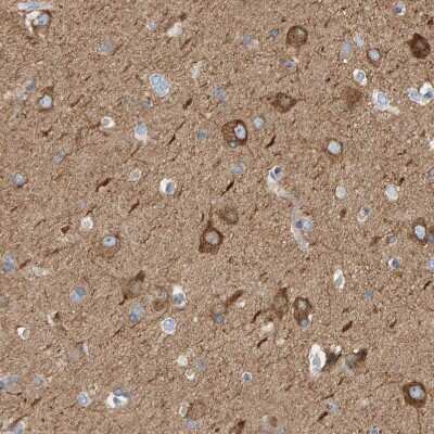 Immunohistochemistry-Paraffin: MAP1B Antibody [NBP1-81261]