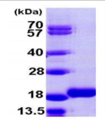 SDS-PAGE: Recombinant Human LC3B2 His Protein [NBP1-99115]