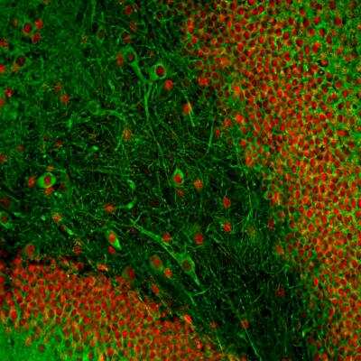 Immunocytochemistry/ Immunofluorescence: MAP2 Antibody (2C4) [NBP2-50032]