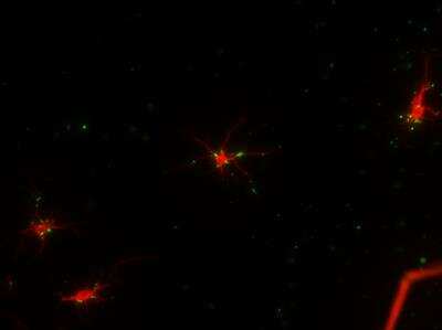 Immunocytochemistry/ Immunofluorescence: MAP2 Antibody (5H11) [NBP1-92711]