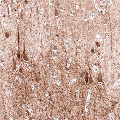Immunohistochemistry-Paraffin: MAP2 Antibody (CL5420) [NBP2-61417]