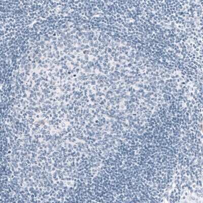 Immunohistochemistry-Paraffin: MAP2 Antibody (CL5420) [NBP2-61417]