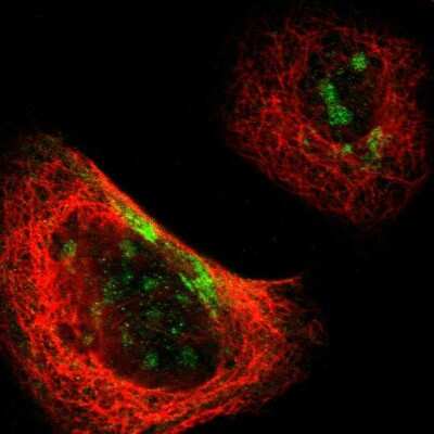 Immunocytochemistry/ Immunofluorescence: MAP2 Antibody [NBP1-81263]
