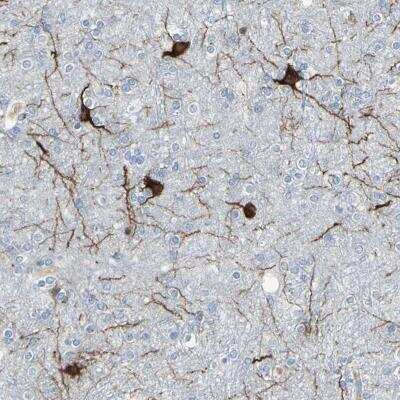 Immunohistochemistry: MAP2 Antibody [NBP1-81264]
