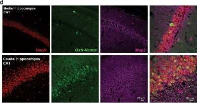 Immunohistochemical Staining of MAP2 in Paraffin Embedded Mouse Hippocampus