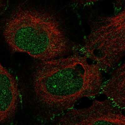 Immunocytochemistry/ Immunofluorescence: MAP3K12 Antibody [NBP2-58000]