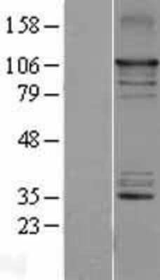 Western Blot: NIK/MAP3K14 Overexpression Lysate [NBL1-12852]