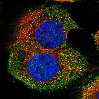 Immunocytochemistry/ Immunofluorescence: MAP3K8/Tpl2/COT Antibody [NBP1-86569]