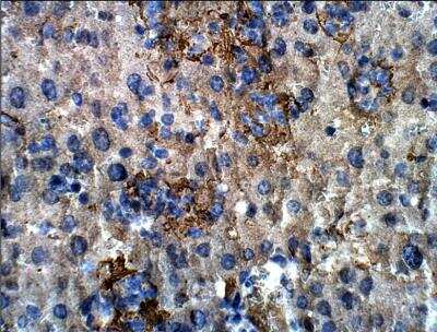 Immunohistochemistry-Paraffin: MAP3K8/Tpl2/COT Antibody [NBP1-62178]
