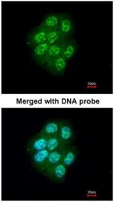 Immunocytochemistry/ Immunofluorescence: MAP3K9 Antibody [NBP1-33704]