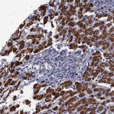 Immunohistochemistry-Paraffin: MAP3K9 Antibody [NBP1-82781]