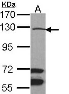 Western Blot: MAP3K9 Antibody [NBP1-33704]