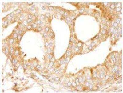 Immunohistochemistry-Paraffin: MAP4 Antibody [NB100-74616]